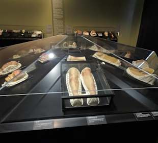 Wachsmodelle von Hautkrankheiten - die Moulagen