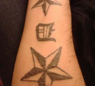 Mein Tattoo / totale Hautreaktion!!