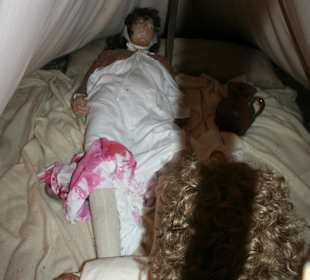 Nachgestellte Geburt