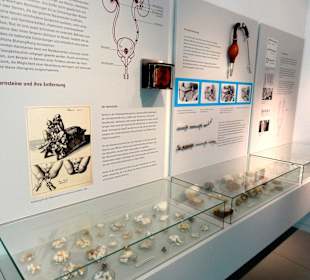 Sammlung von Nieren- und Blasensteinen