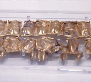 Nationales Archäologisches Museum