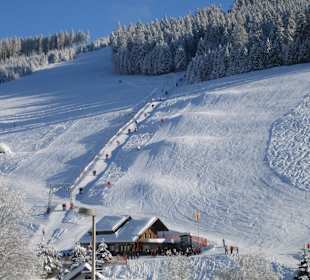Stübenwasenlift Talstation