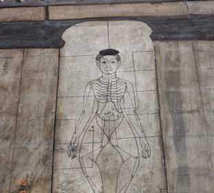 Die Anfänge der Akupunktur