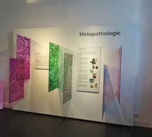 Infotafeln zur Histopathologie