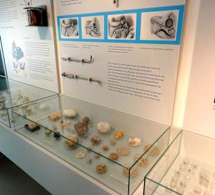 Sammlung von Nieren- und Blasensteinen